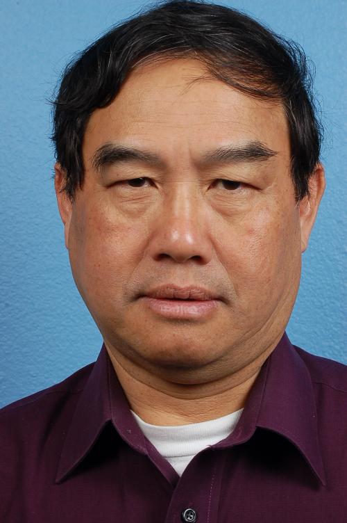 Blepharoplasty Before and After | Cheng Plastic Surgery